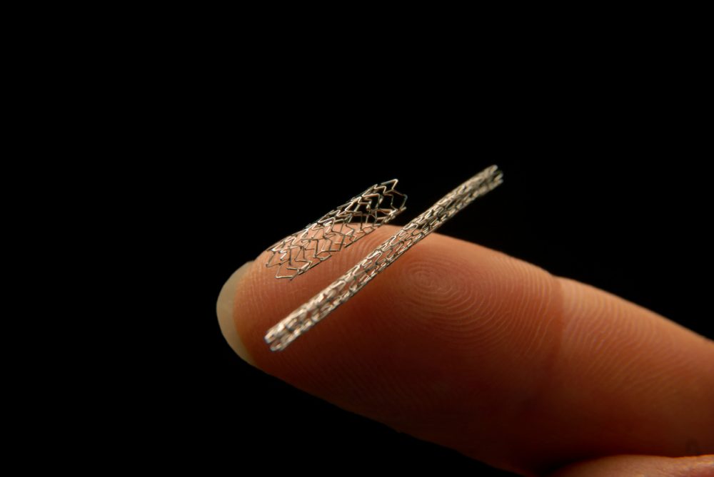 Inside the stent: investigating the boom in cardiac surgery