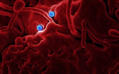 Lockdown or no lockdown: global responses, lessons for the next pandemic