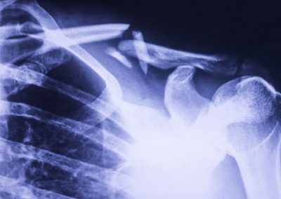End neo-liberal experiment: gutting of bureaucracy led to vaccine and aged care failures