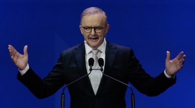 Anthony Albanese