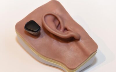 Shares in world-leading hearing implant firm hit a low